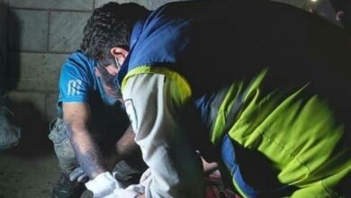 انفجار نارنجک دست‌ساز در پرند حادثه آفرید/ مچ دست کودک ۱۲ ساله ‌قطع ‌شد